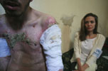 UNHCR - Syrie